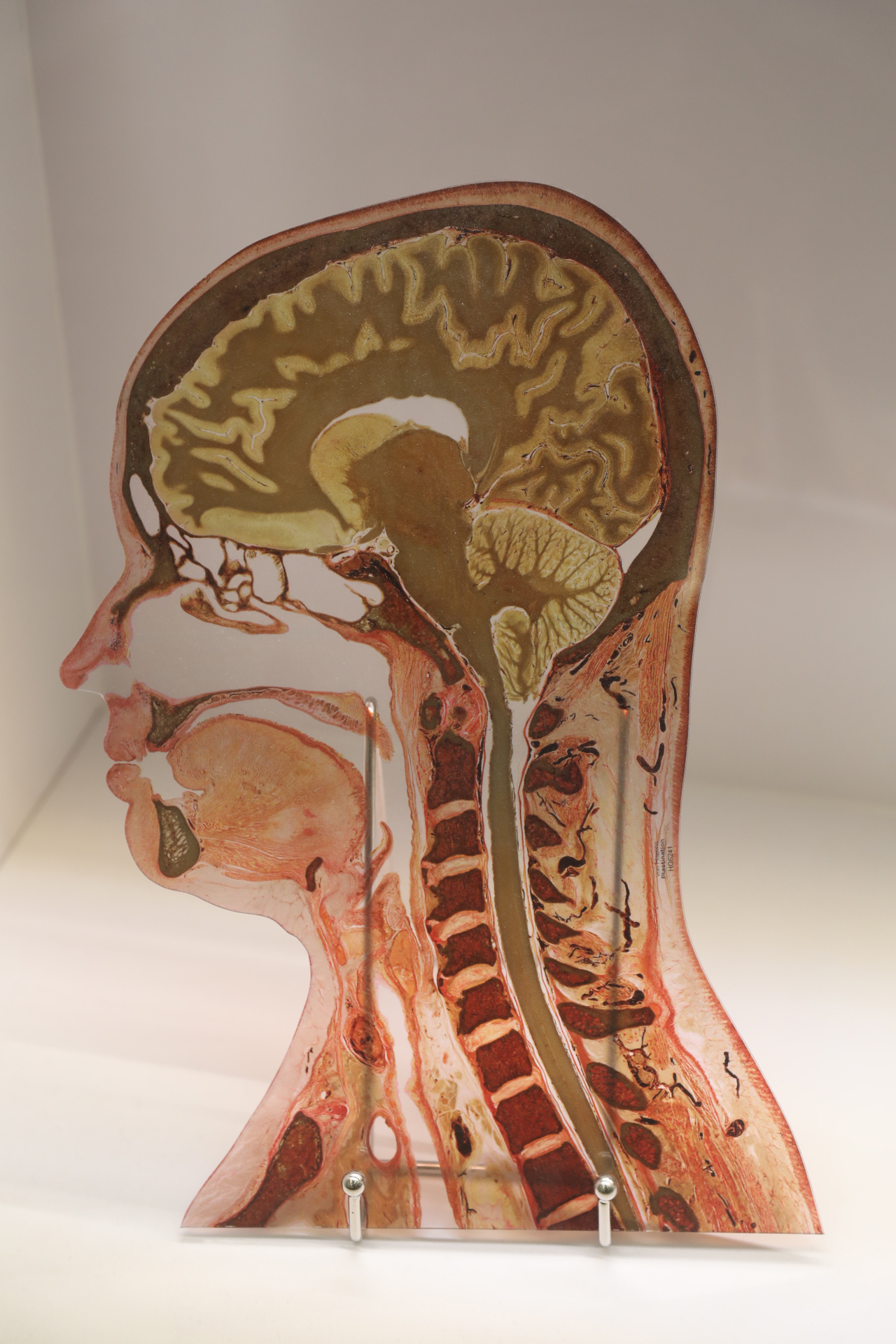 Preserved slice through a human head showing the brain in place